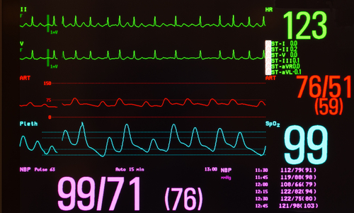 Biofeedback Screen training heart, respiration HRV